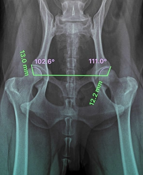 Radiología Digital de Alta Resolución